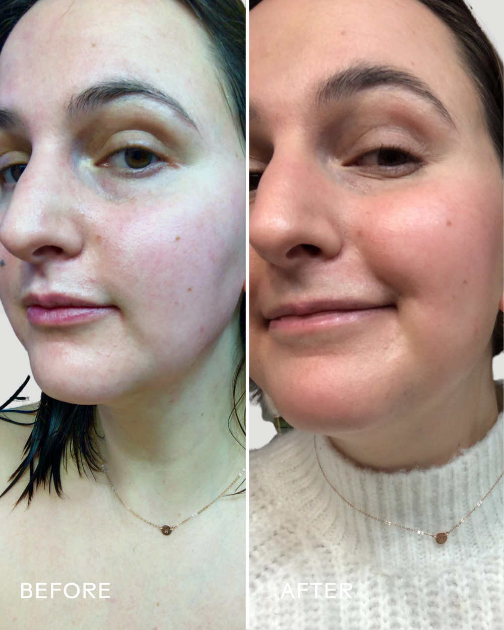 SkinHero™ Calendula + 2% Bakuchiol Bio-Retinol Serum