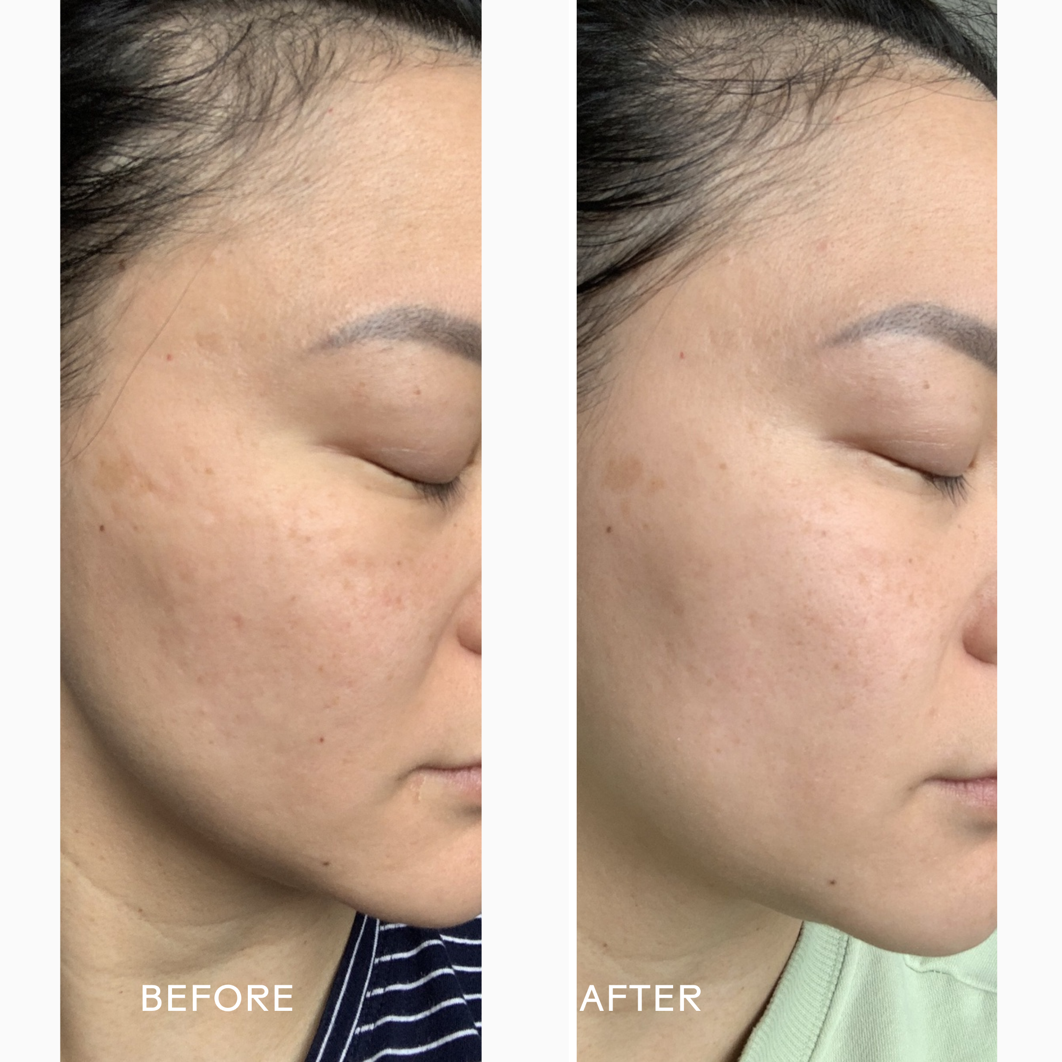 Radiance Grape Stem Cell + Squalane Ultra-Hydrating Cream